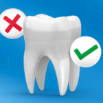 mitos da cirurgia dental
