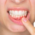 o-que-e-periodontia